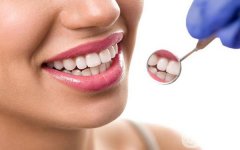 做牙齒稀疏禁忌人群及適宜人群有哪些?