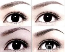 激光洗眉會(huì)出血嗎？洗眉毛不出血的激光儀有哪些？