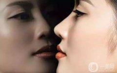 做硅膠延長(zhǎng)鼻小柱禁忌人群及適宜人群有哪些?