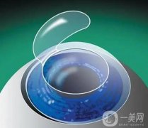 眼部做激光手術(shù)有哪些危害？術(shù)后怎么護理？