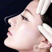 做鼻孔縮小調(diào)節(jié)果怎么樣?果保持時間多久?