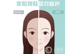 果酸換膚的果可以維持多久？有哪些癥狀適用于果酸換膚？