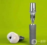 不同瑞士種植體iti有哪些優(yōu)缺點？