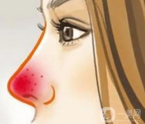 酒渣鼻怎么調(diào)節(jié)好？酒渣鼻能治好嗎？