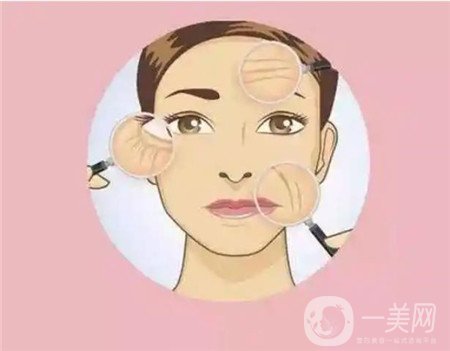 熱瑪吉電波拉皮*果怎么樣？維持多久？