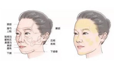 臉部自體脂肪填充價(jià)格一般是多少？*果好不好？