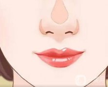 鼻頭縮小的操作步驟？會導(dǎo)致增生出現(xiàn)嗎？