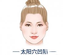 玻尿酸豐太陽穴的優(yōu)缺點？注意事項有啥？
