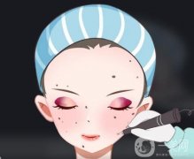 激光點(diǎn)痣后不能吃什么？可以吃辣椒嗎？