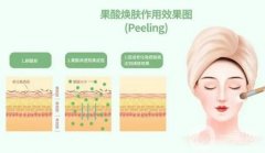 果酸換膚前后需要注意什么？這幾點一定要注意