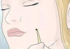 激光點痣后的凹洞如何護理？激光點痣后要忌口多久？
