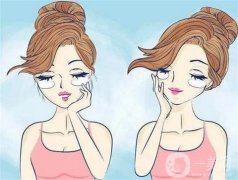 什么因素影響去除眼袋的價格？去眼袋的誤區(qū)有哪些？