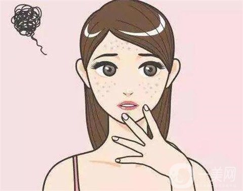 去老年斑的方法都有哪些呢 哪種比較好？