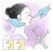延長鼻小柱可以用什么材料？有哪些手術(shù)方法？