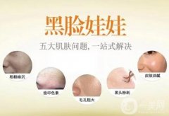 黑臉娃娃激光美容術(shù)前術(shù)后注意事項有哪些？
