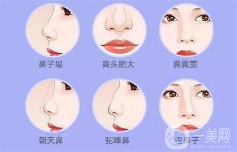 徐州二院整形美容科價(jià)格表，附隆鼻整形案例