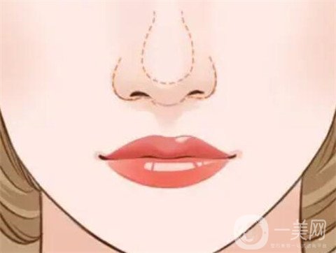 徐州二院整形美容科價(jià)格表，附隆鼻整形案例