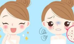 激光祛斑價(jià)格貴不貴？一般需要多少錢就可以做啦？