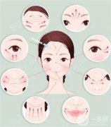 哪些皺紋可以手術(shù)去除？具體有哪些呢？