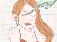 切眉后過(guò)多久可以紋眉？術(shù)后怎么護(hù)理？