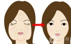 熱瑪吉緊膚價格貴不貴？有哪些因素會影響到價格？這些注意事項需知
