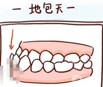 地包天調(diào)節(jié)方法有哪些？注意事項？