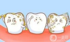 氟斑牙是如何形成的？怎么調(diào)節(jié)？