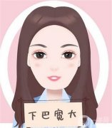墊下巴多久可以側(cè)睡？恢復(fù)期是多久？