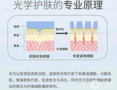 光子嫩膚性怎么樣？
