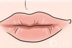 如何防止嘴唇出現(xiàn)皺紋？嘴唇上有皺紋是什么原因？