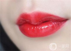 注射玻尿酸豐唇有哪些優(yōu)點(diǎn)？