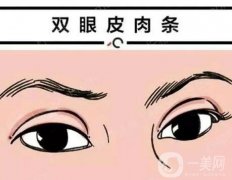 雙眼皮的肉條多久會(huì)消失？