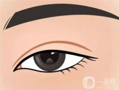 不同的人適合什么樣的雙眼皮？