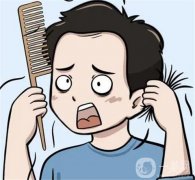 可以去掉美人尖嗎？