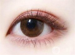 哪些情況適合開眼角?如何判斷我的眼距是否過寬?