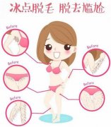什么季節(jié)脫毛好？春季脫毛好的原因？