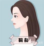 鞍鼻整形的材料有哪些？鞍鼻整形什么假體好？
