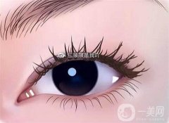 不適合開眼角的人群？不適合開眼角的人群有哪些？