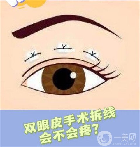 寧波市第一醫(yī)院整形美容科割雙眼皮怎么樣？?jī)r(jià)格表及案例詳情