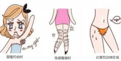 光子脫毛的價(jià)格是多少呢？貴嗎？