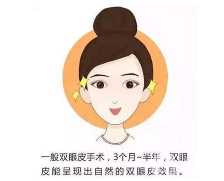 杭州格萊美醫(yī)院做雙眼皮咋樣?案例價(jià)格表公開