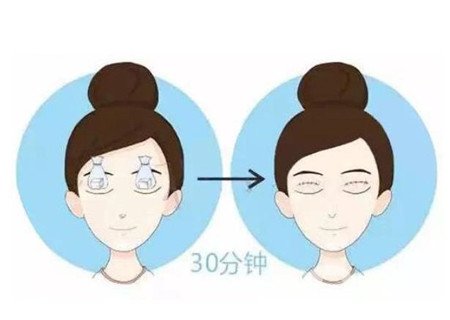 邯鄲三院雙眼皮做得好嗎？整形價(jià)格表及案例分享
