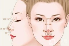 鼻唇溝怎么填充？鼻唇溝是如何形成的？