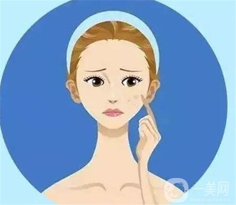 激光去黃褐斑*果維持時(shí)間,激光去黃褐斑*果