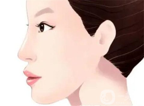湖南省人民醫(yī)院整形美容科隆鼻*果如何？看價格表及案例實述