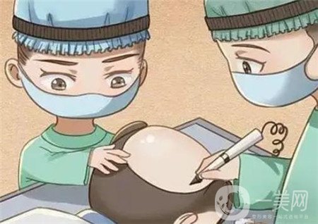 西南醫(yī)院美容整形科*新價格表公布,附植發(fā)案例*果