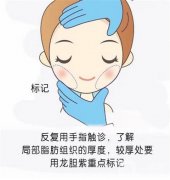 抽脂減肥后的疼痛怎么緩解？面部可以抽脂嗎？