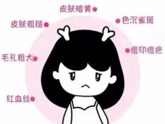 光子嫩膚單模式和全模式的區(qū)別是什么?