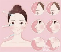 填充自體脂肪填充后可以熱敷嗎