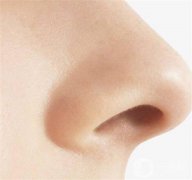 微創(chuàng)隆鼻要多少錢?需要多長時(shí)間恢復(fù)?